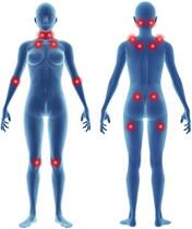 Fibromyalgia